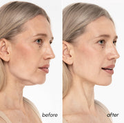 MAREE V Line Lifting Mask - Gold Face Lift Tape & Double Chin Lifting Mask | Collagen mask for neck lifting & tightening, neck wrinkle patches, face lifting tape, chin strap for double chin for women