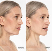 MAREE V Line Lifting Mask - Gold Face Lift Tape & Double Chin Lifting Mask | Collagen mask for neck lifting & tightening, neck wrinkle patches, face lifting tape, chin strap for double chin for women
