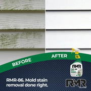RMR-86 Instant Mold and Mildew Stain Remover Spray - Scrub Free Formula, 32 Fl Oz